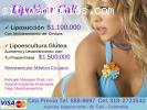 Liposucción $1.100.000 Con Moldeamient