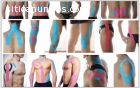 Curso de Kinesiotape para esteticistas