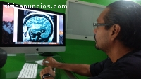 Neurocirujano Certificado Dr. Francisco