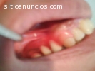 urgencias dentales 24 hrs Dental Saucedo