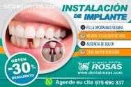 DENTAL ROSAS – CLÍNICA DENTAL EN SJL