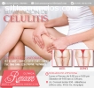 Elimina la celulitis - Clínica Renacer